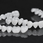 Facetas Odontológicas Removíveis - Prótese Superior e Prótese Inferior