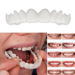 Facetas Odontológicas Removíveis - Prótese Superior e Prótese Inferior